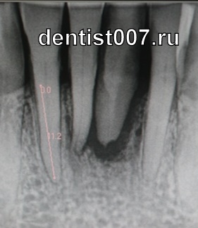 местная или системная??? - RG(2).jpg